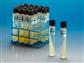 PDA, Potato Dextrose Agar, 10mL tubes, test for fungal contamination, 20/CS